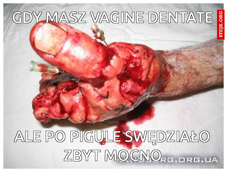 Gdy masz vagine dentate