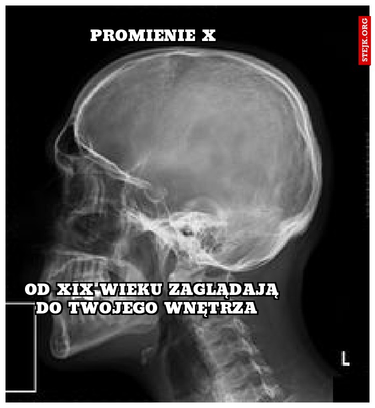PROMIENIE X