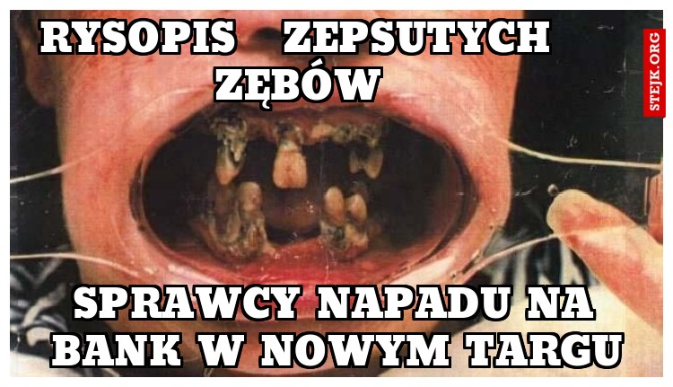 rysopis   zepsutych zębów