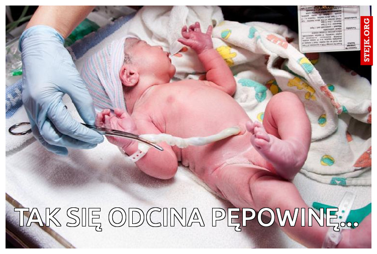 tak się odcina pępowinę...