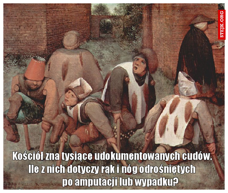 Kościół zna tysiące udokumentowanych cudów. Ile z nich dotyczy rąk i nóg odrośniętych po amputacji lub wypadku?