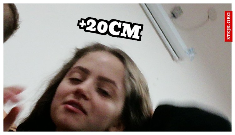  20CM