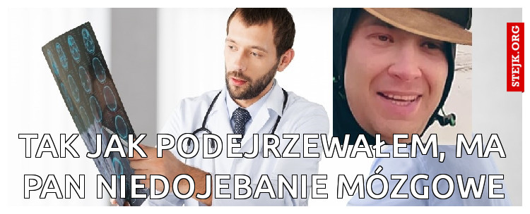 tak jak podejrzewałem, ma pan niedojebanie mózgowe