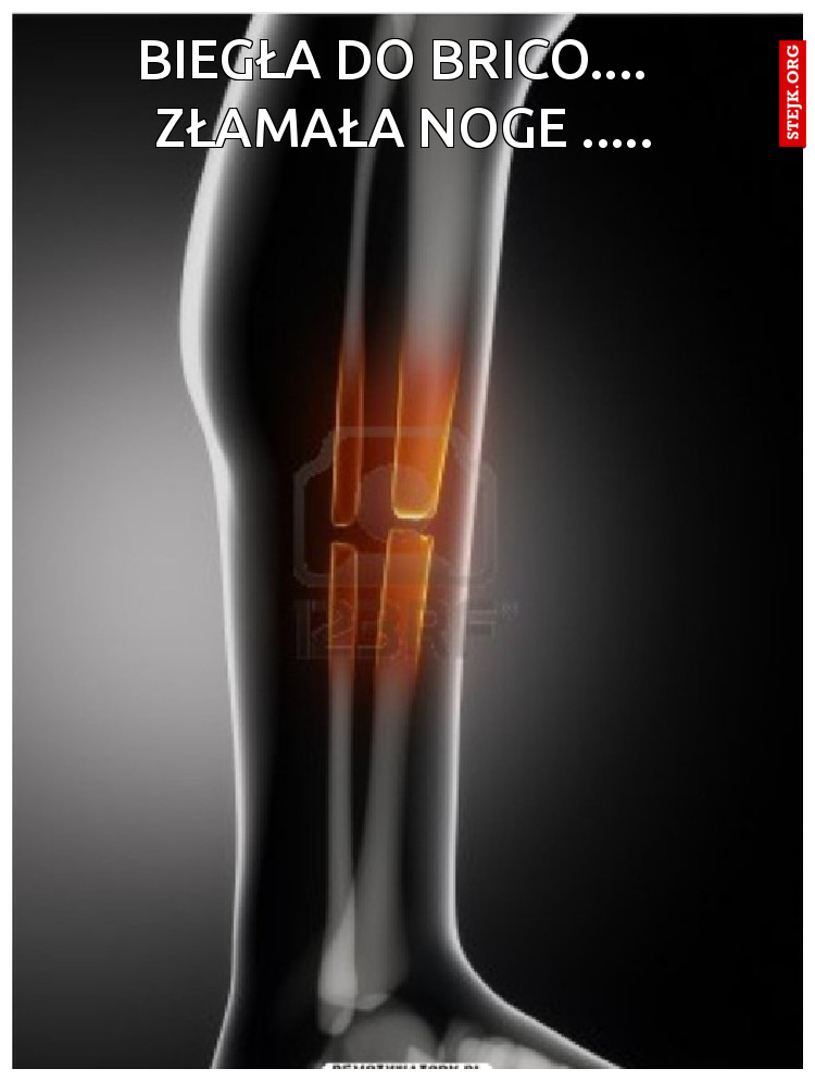 Biegła do Brico....   Złamała noge .....