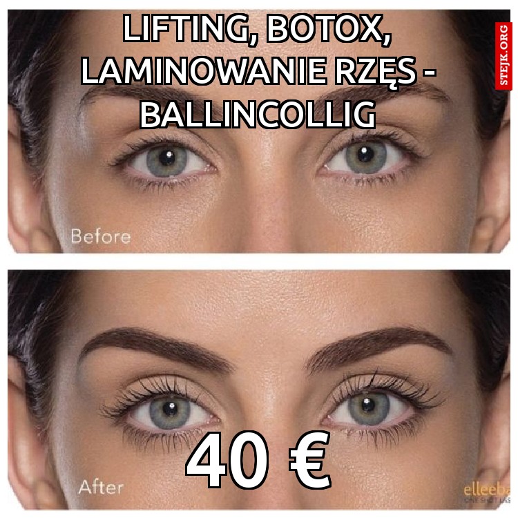 Lifting, botox, laminowanie rzęs - ballincollig