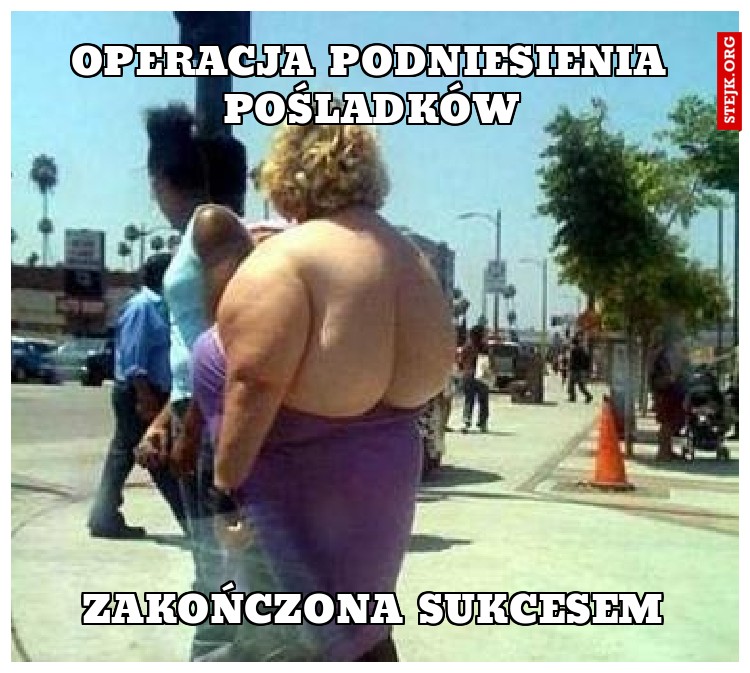 Operacja podniesienia pośladków
