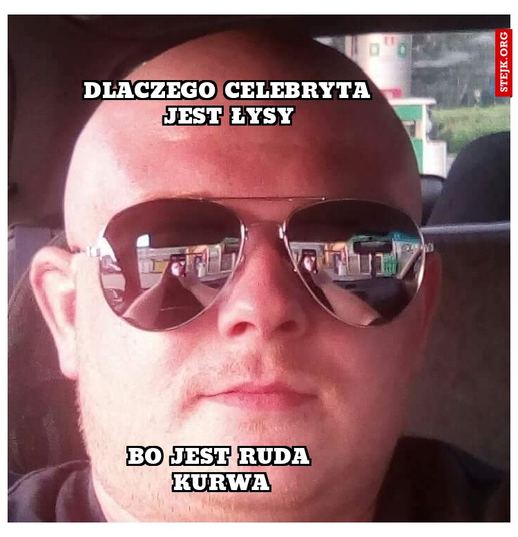 Dlaczego celebryta jest Łysy