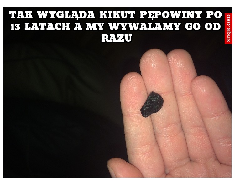 Tak wygląda kikut pępowiny po 13 latach a my wywalamy go od razu