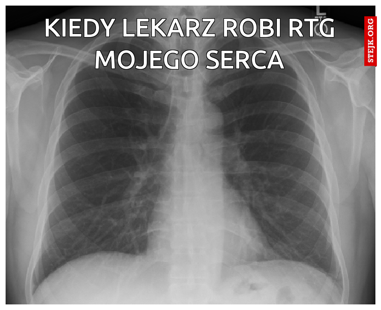 Kiedy lekarz robi RTG mojego serca