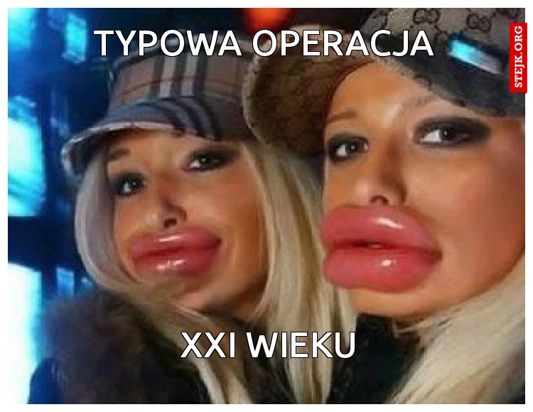typowa operacja