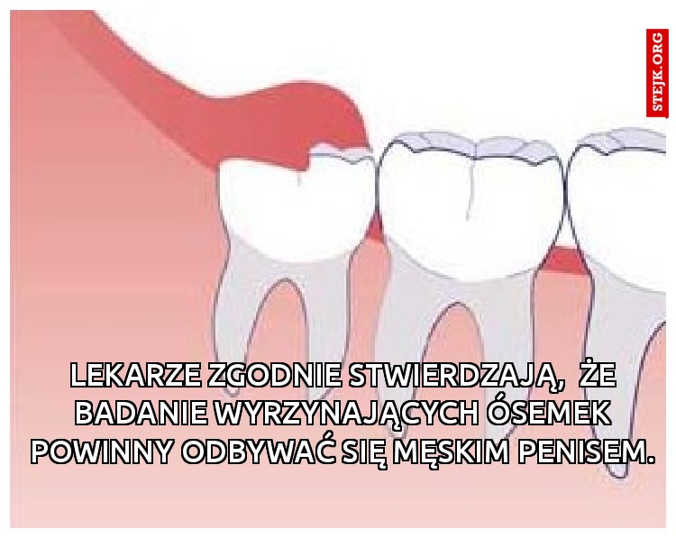 Lekarze zgodnie stwierdzają,  że badanie wyrzynających ósemek powinny odbywać się męskim penisem. 
