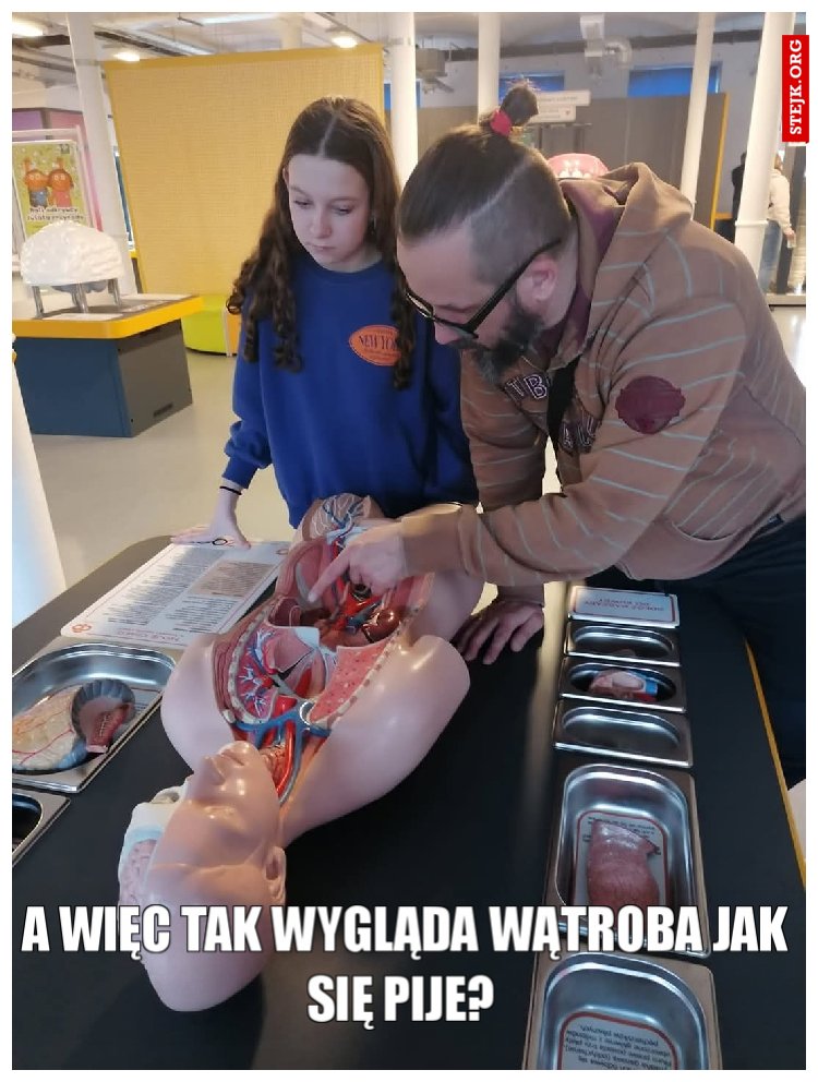 A więc tak wygląda wątroba jak się pije? 