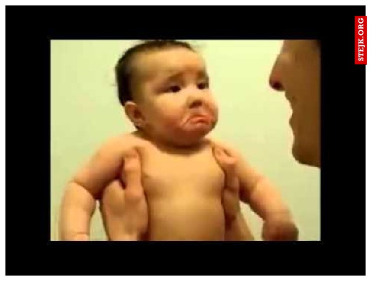 xd